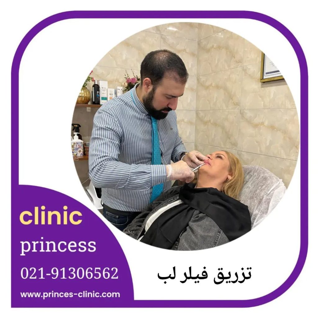 تزریق فیلر لب