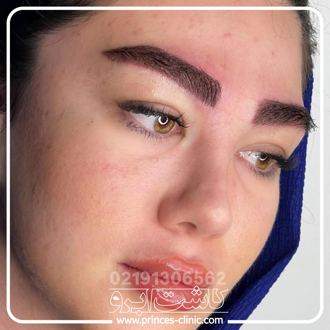 -ابرو-3-1.png