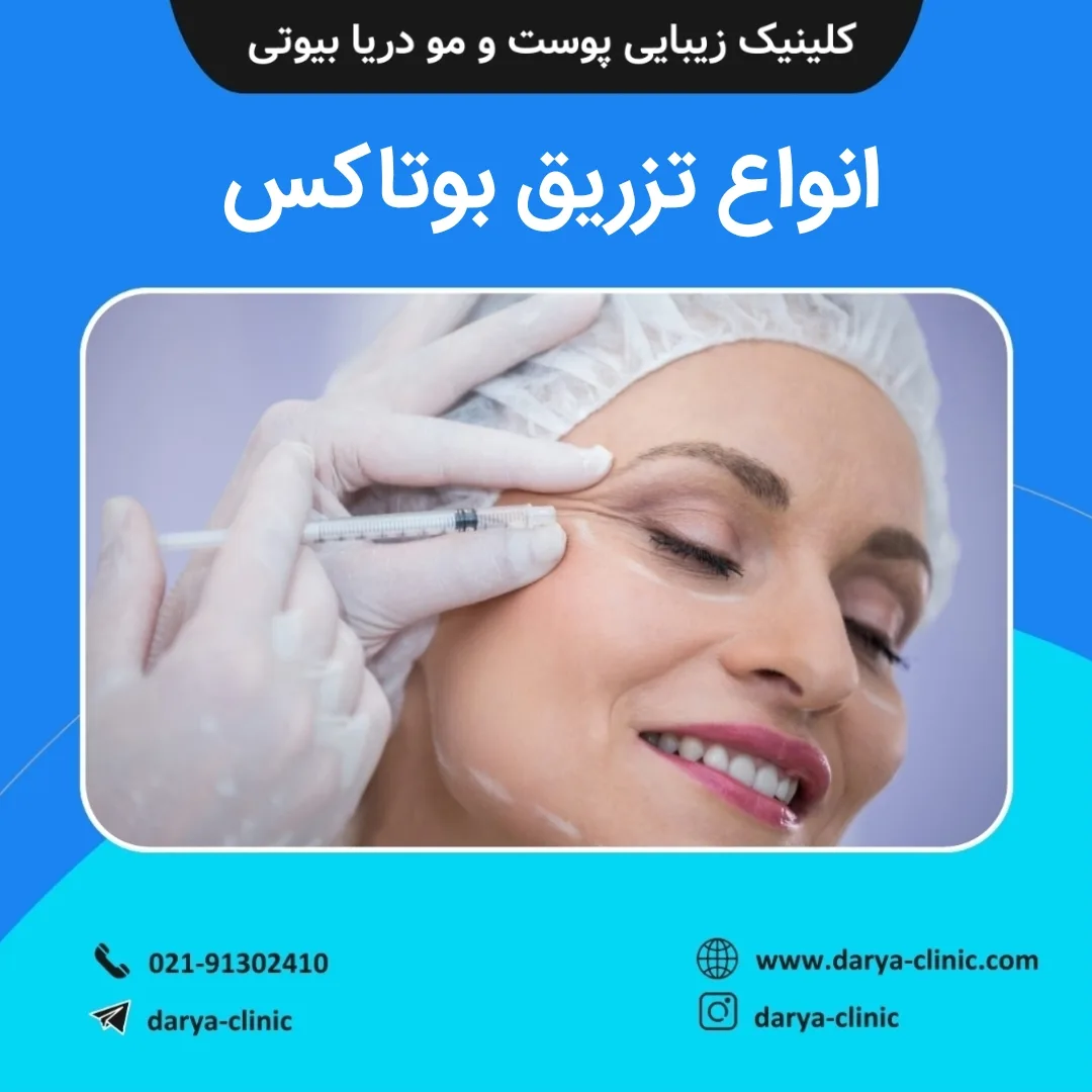 انواع تزریق بوتاکس