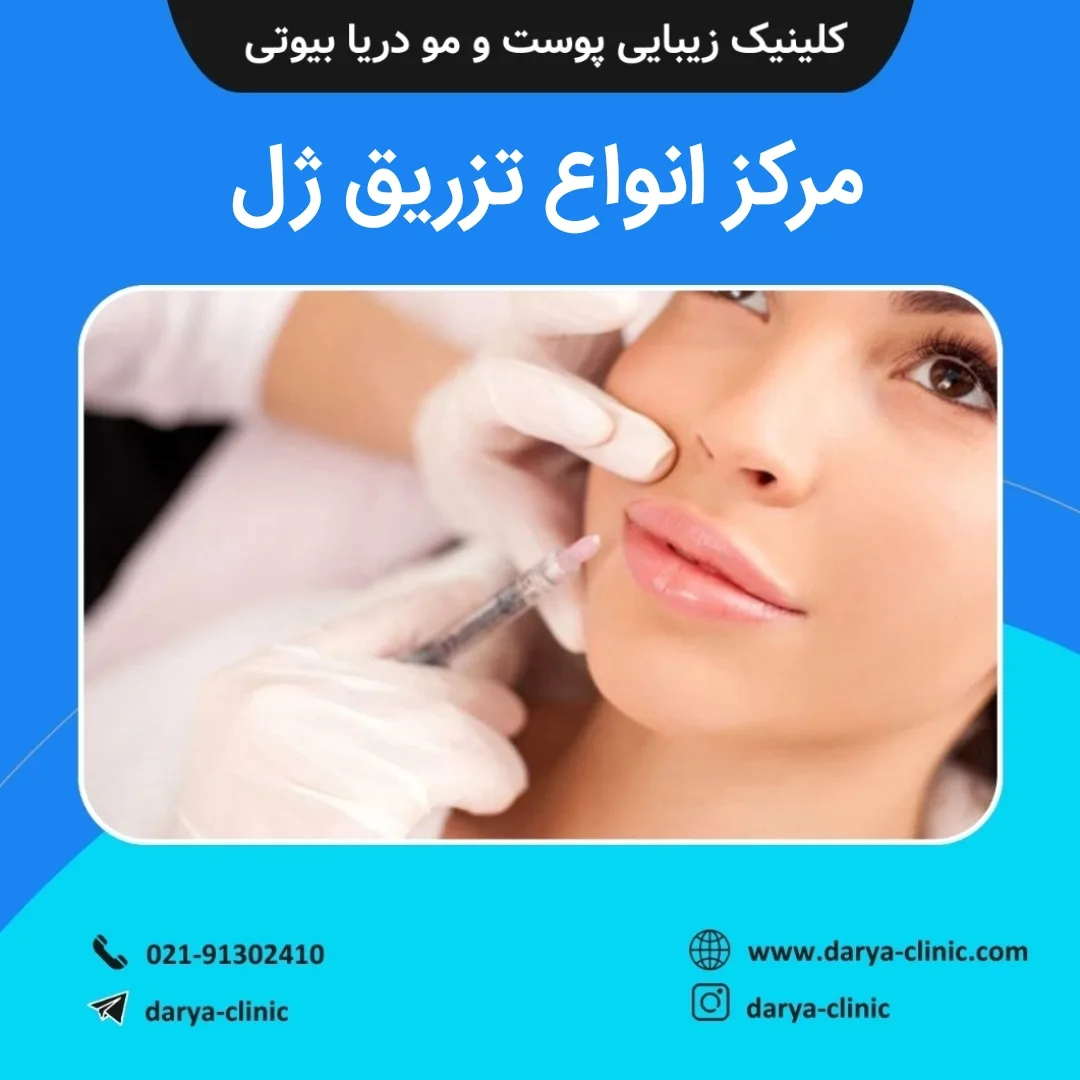 مرکز انواع تزریق ژل